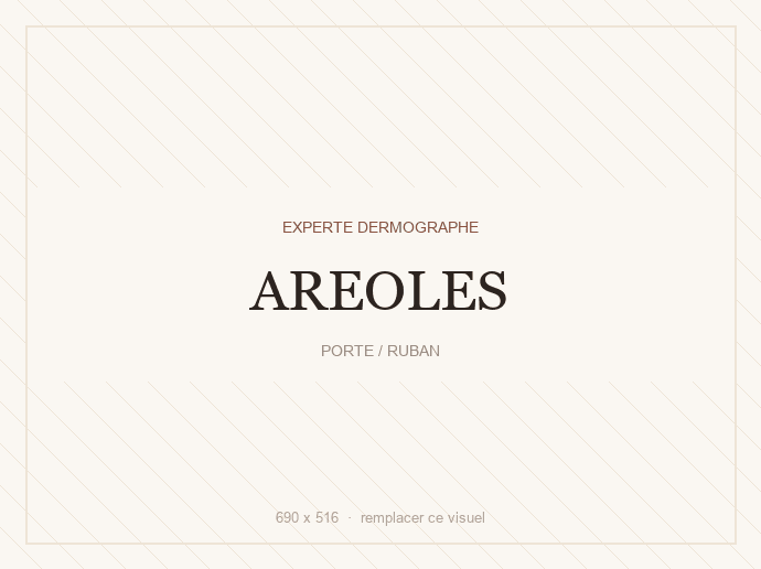 Aréoles — mastectomie