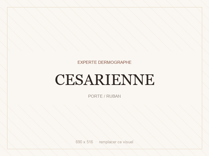 Césarienne