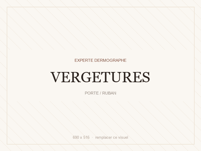 Vergetures